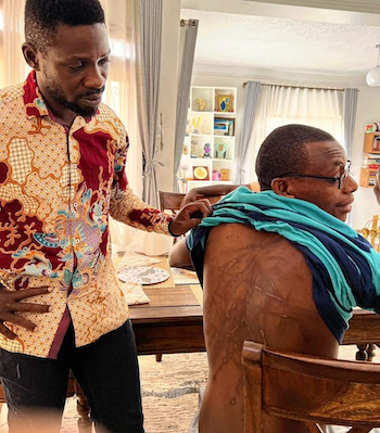 Did we imagine Kakwenza’s mutilated back?