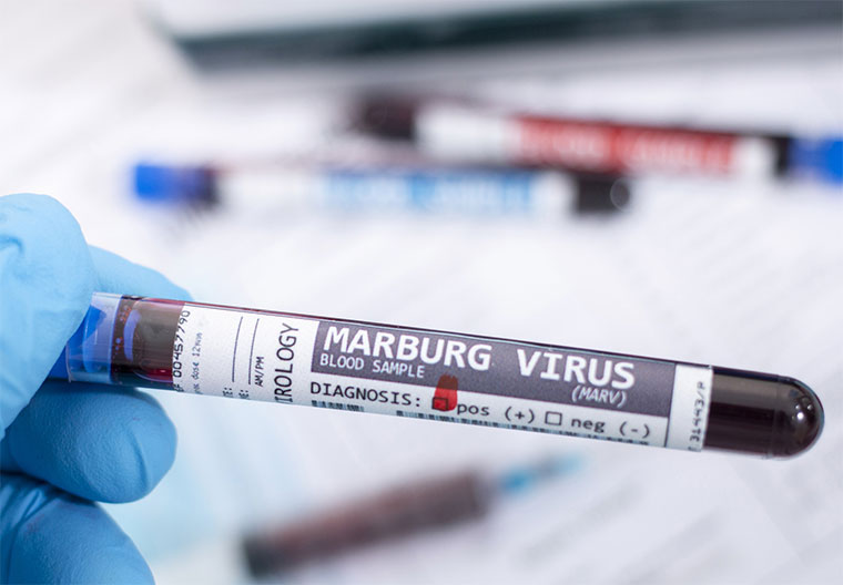 marburg-virus-test