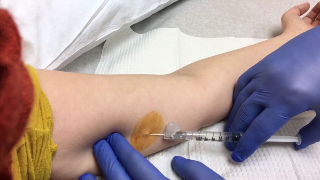 weight-loss-after-nexplanon-removal-1024x576-1 weight loss after Nexplanon removal
